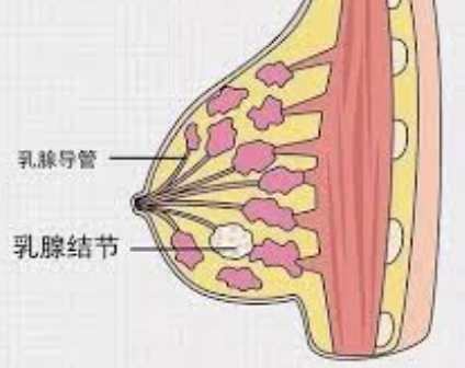 葉狀肉瘤症狀