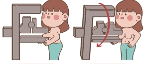 乳癌診斷方式