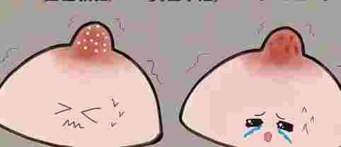 乳頭水腫症狀