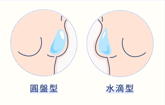 果凍隆乳前必知 果凍隆乳前必知