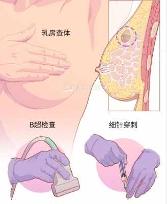 乳房水泡治療方法