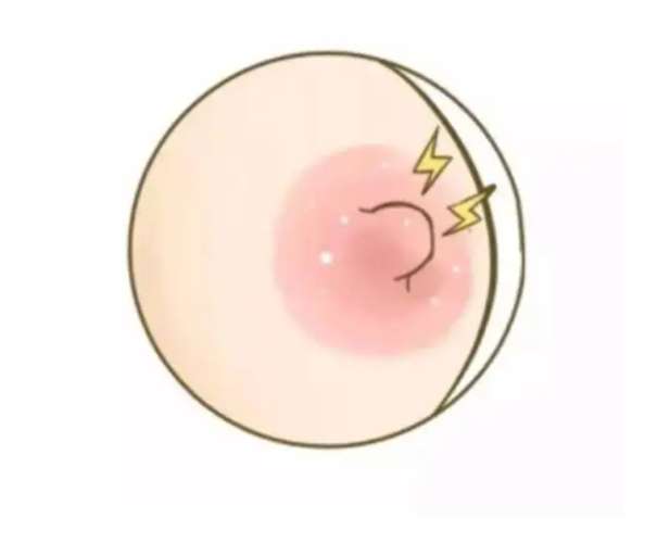 乳頭 小 白 點