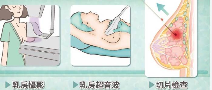 HER2 存活率