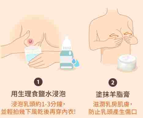 乳頭痛改善