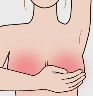 乳頭 破 皮