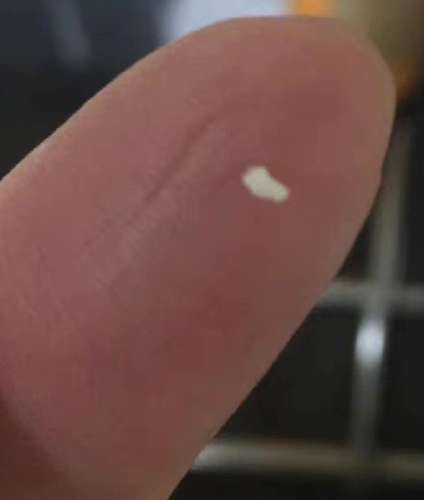 解決乳頭小白點的方法 解決乳頭小白點的方法
