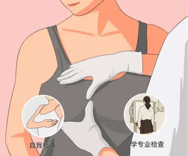 乳房檢查 乳房檢查