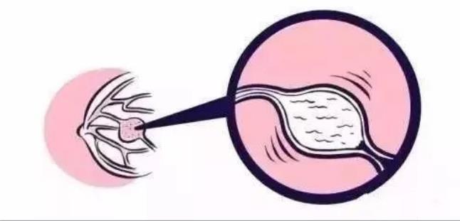 乳腺增生治療 