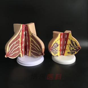 側乳癌 