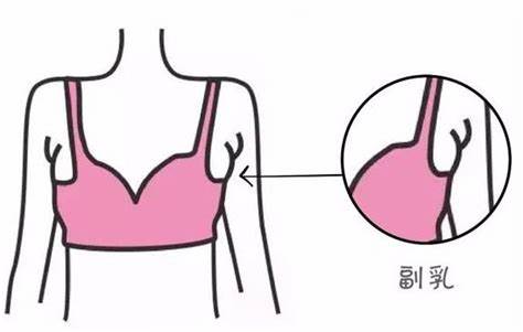 側乳酸痛